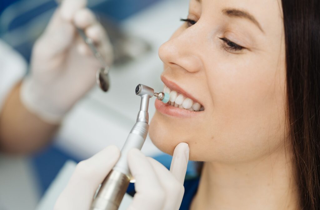 Close-up of a patient’s mouth while a dental professional performs teeth scaling.
