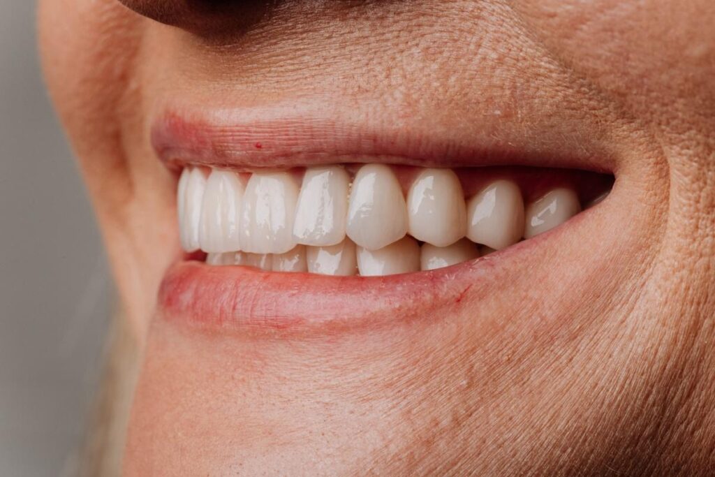 Up close image of person smiling with brand new set of teeth.